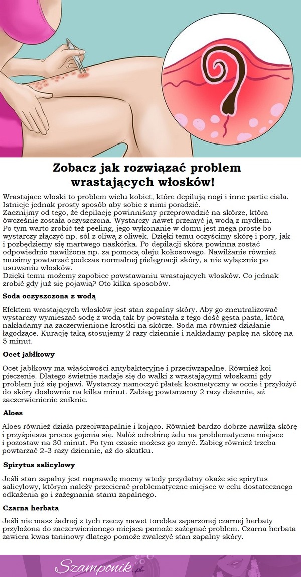 Zobacz, jak rozwiązać PROBLEM wrastających włosków! MEGA!