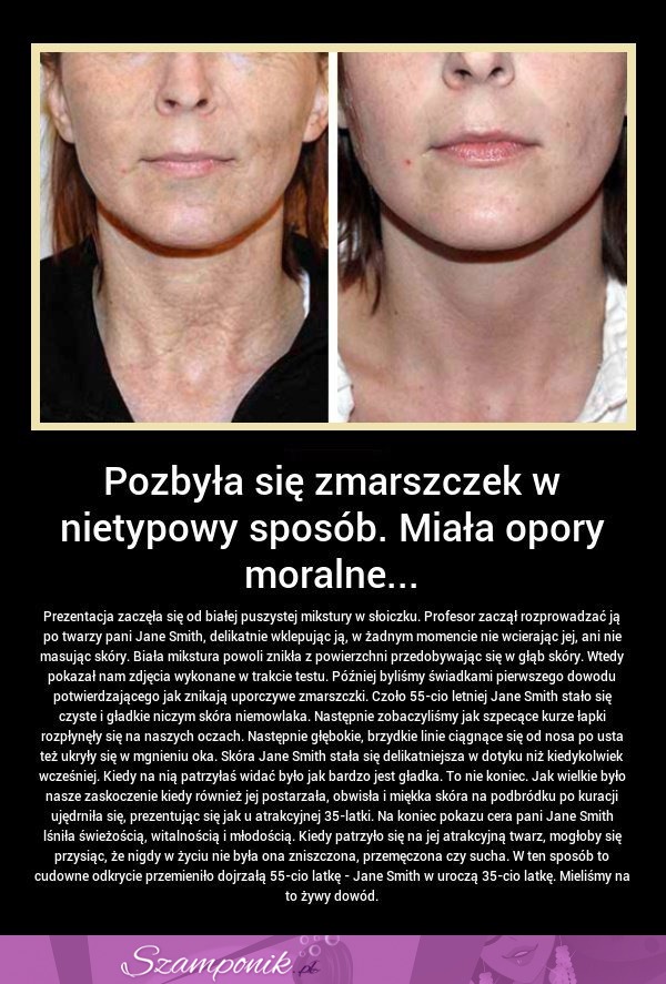 Pozbyła się zmarszczek w nietypowy sposób...