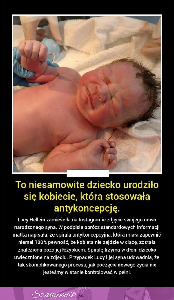 To niesamowite dziecko urodziło się kobiecie, która stosowała antykoncepcję!