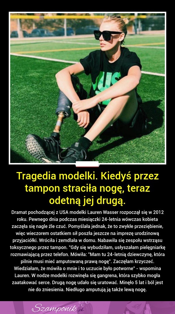 Tragedia modelki. Kiedyś przez tampon straciła nogę, teraz odetną jej drugą...