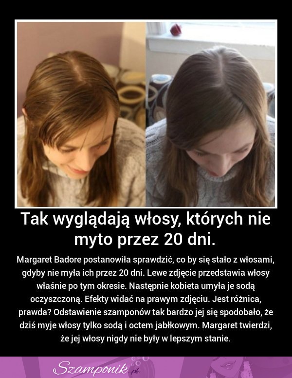 Tak wyglądają WŁOSY, których nie MYTO przez 20 dni! WOW