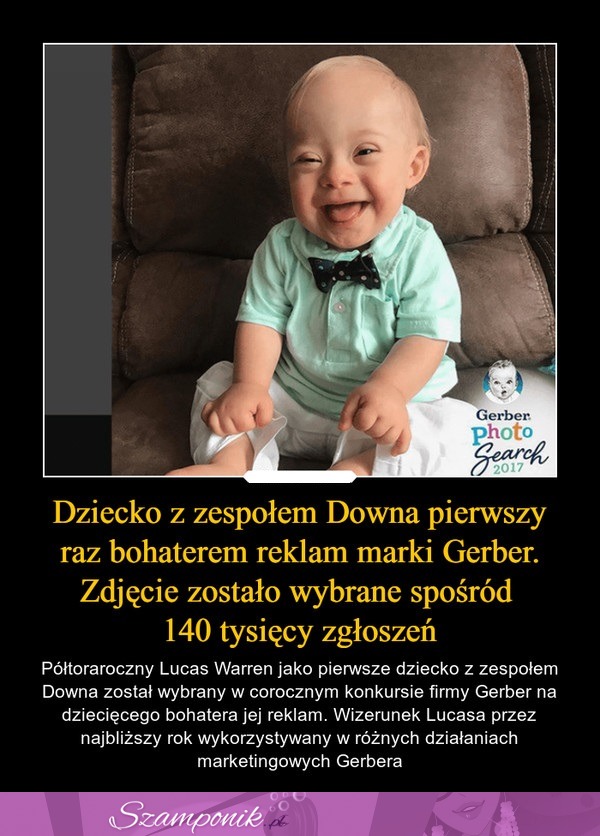 Dziecko z zespołem Downa pierwszy raz bohaterem reklam marki Gerber!