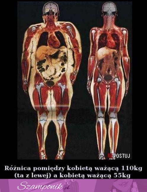 Jak wygląda w środku ciało 110kg a 55kg! Jaka różnica, szok!