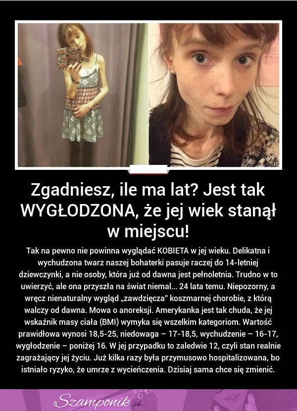 Ta dziewczyna cierpi na ANOREKSJĘ. Jej wskaźnik BMI wymyka sie WSZELKIM kategoriom...