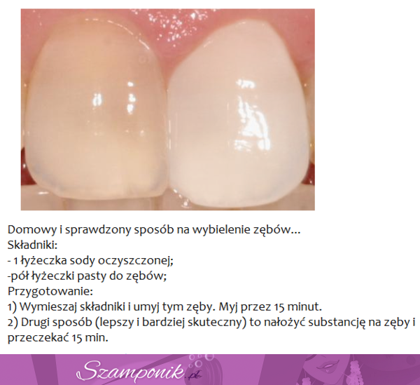 Poznaj najlepszy i najprostrzy sposób na białe zęby!