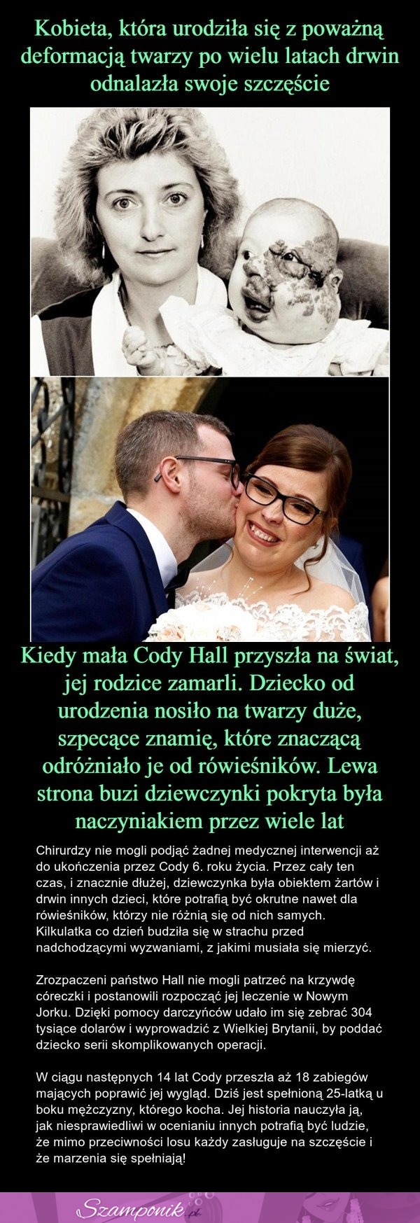 Niesamowita przemiana kobiety, która urodziła się z deformacją twarzy! :o