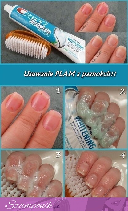 Najlepszy sposób na piękne paznokcie! Zobacz jak usuwać z nich plamy za pomocą...