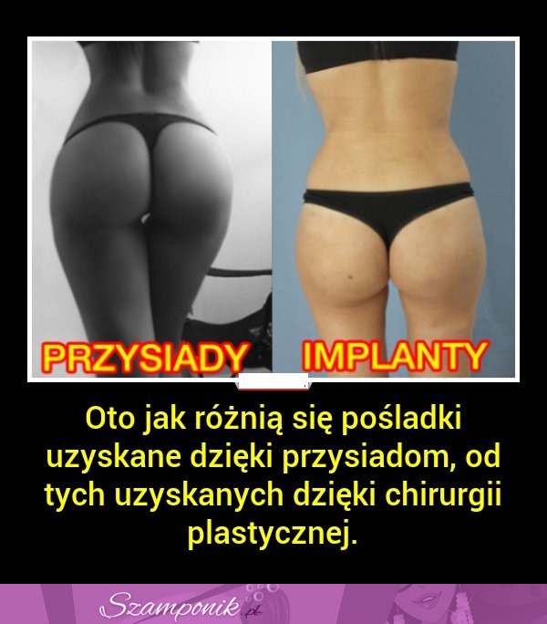 ZOBACZ, jak różnią się NATURALNE pośladki od sztucznych...