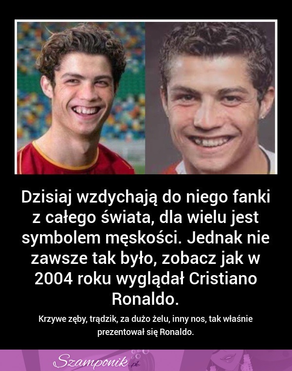 Dzisiaj WZDYCHAJĄ do niego MILIONY FANEK ale kiedyś tak nie wyglądał! Zobacz o kim mowa ;P