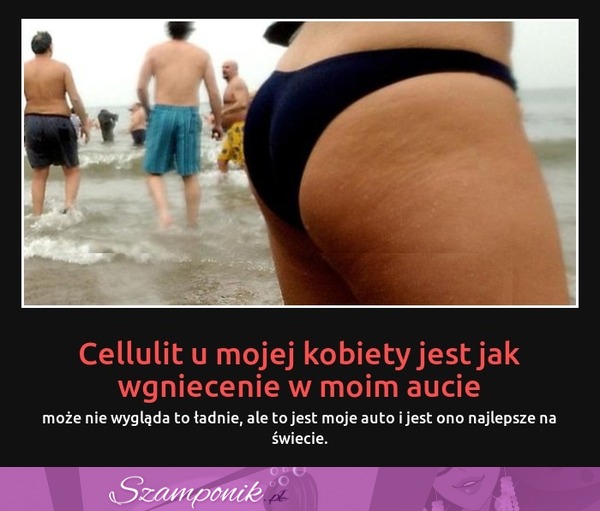 Cellulit u mojej kobiety jest jak wgniecenie w moim aucie... Zobacz dlaczego! :)