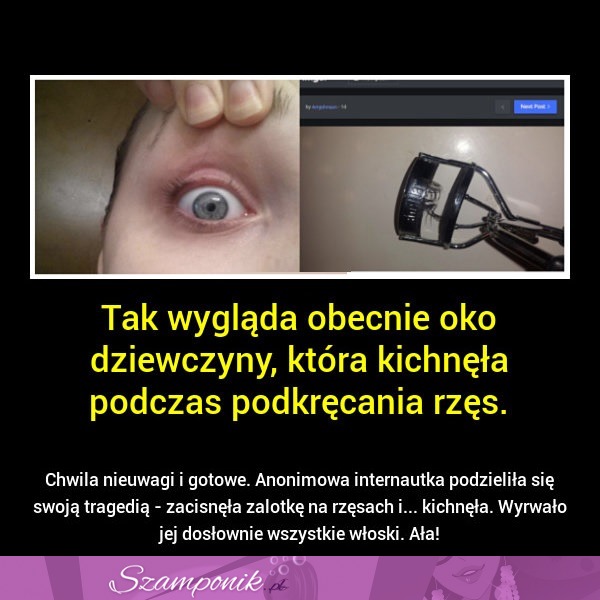 Używasz ZALOTKI do RZĘS! Uważaj bo może spotkać Cię taka sama TRAGEDIA jak tą dziewczynę!