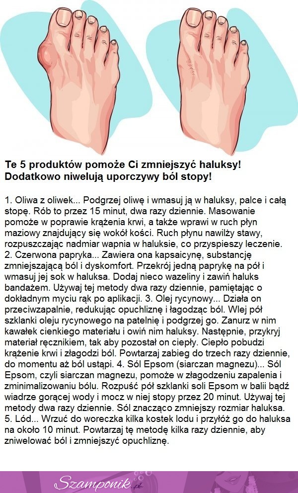 Te 5 produktów pomoże Ci zmniejszyć haluksy i zniwelować ból!