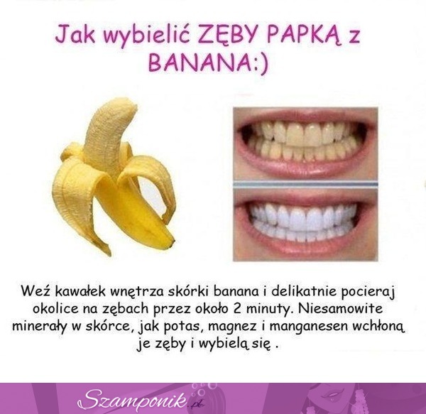 Zobacz domowy sposób na białe zęby! TO DZIAŁA! ;-)