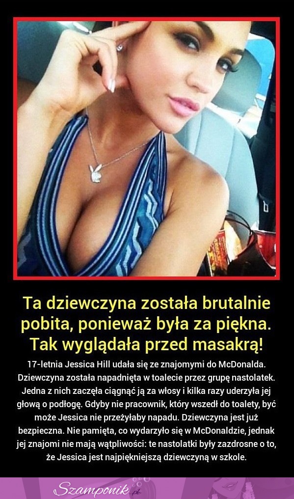 Ta dziewczyna została BRUTALNIE pobita, ponieważ była za piękna. Tak WYGLĄDA przed masakrą!