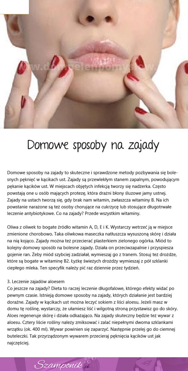 Domowe SPOSOBY na zajady! Pomocne...