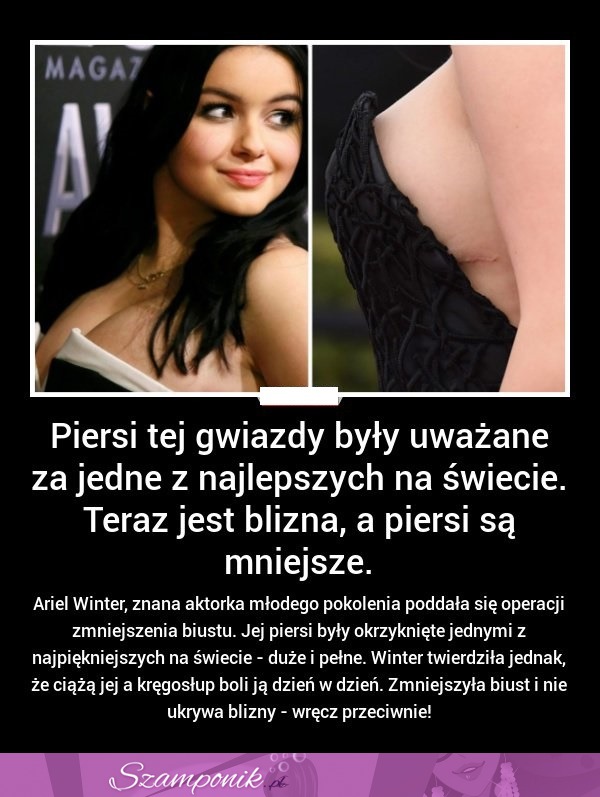 Piersi tej gwiazdy były uważane za jedne z najlepszych na świecie... Teraz jest blizna...