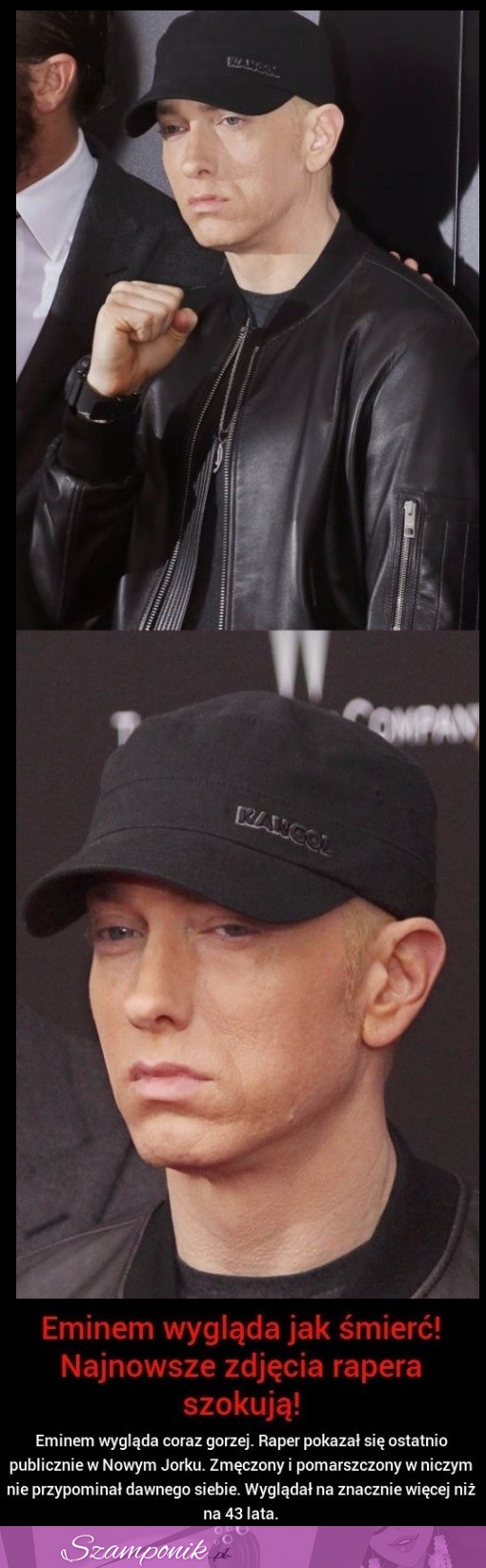 Tak wygląda teraz EMINEM!  Na prawdę STRASZNIE ŹLE!