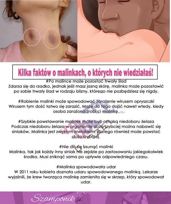 Kilka faktów o malinkach, o których nie wiedziałaś!