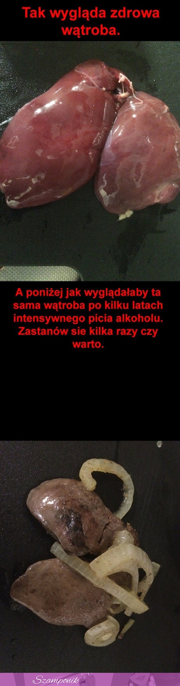 Wątroba