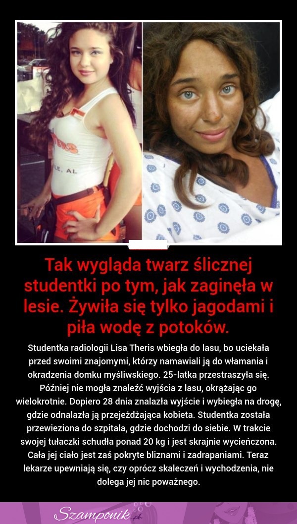 Tak wygląda twarz ślicznej studentki po tym, jak zaginęła w lesie...