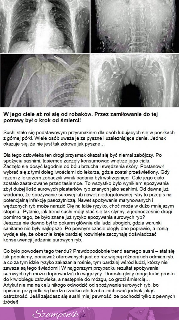 W jego ciele aż roi się od robaków... MASAKRA!