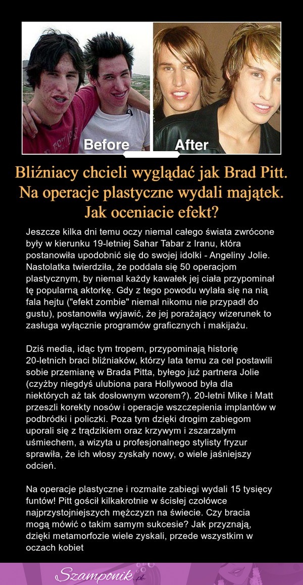 Bliźniacy chcieli wyglądać jak Brad Pitt. Na operacje plastyczne wydali majątek. Jak oceniacie efekt?