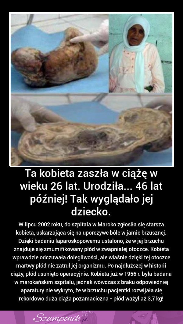 Ta kobieta zaszła w CIĄŻĘ w wieku 26 lat! Urodziła 46 lat PÓŹNIEJ, MASARKA!