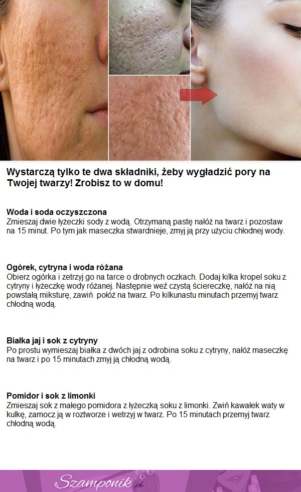 WYGŁADŹ pory na SWOJEJ twarzy! To takie PROSTE!