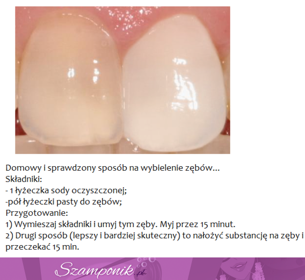 Poznaj najlepszy sposób na białe zęby! ;)