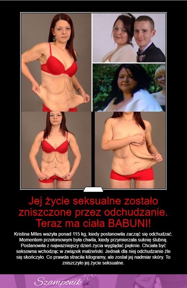 Przez ODCHUDZANIE zniszczyła sobie ŻYCIE seksualne... MASAKRA!