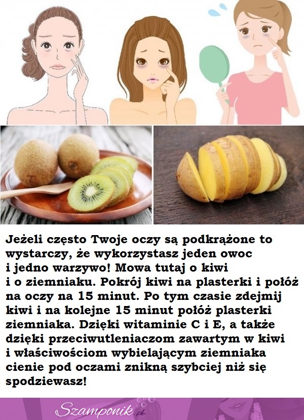 Pozbądź się cieni pod oczami NATURALNYM sposobem!