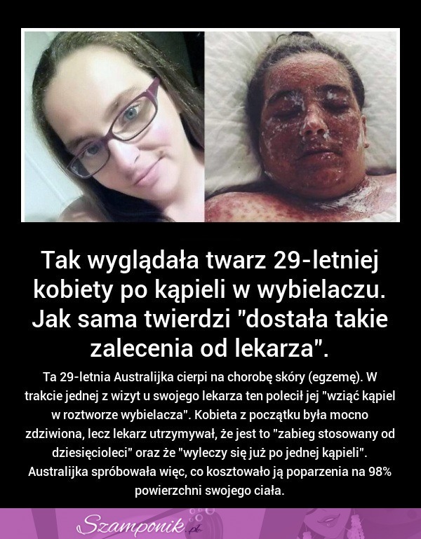 Ta kobieta zrobiła sobie KĄPIEL w WYBIELACZU! SZOK jak ona wygląda?!!