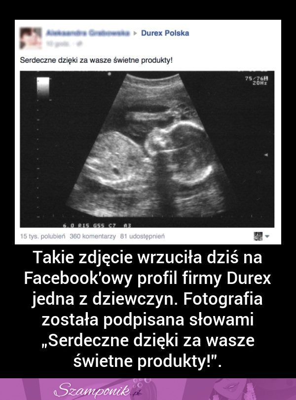 MASAKRA! Takie ZDJĘCIE wrzuciła na FB  firmy Durex jedna dziewczyna!