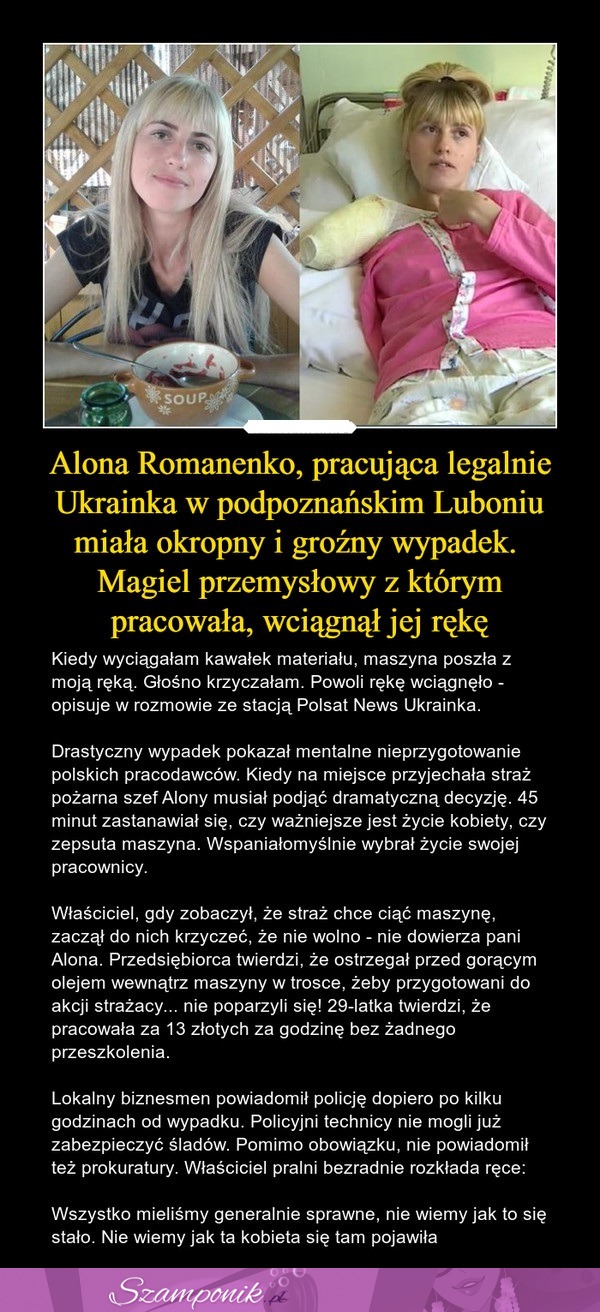 Pracująca legalnie Ukrainka miała groźny wypadek. Magiel przemysłowy wciągnął jej rękę!