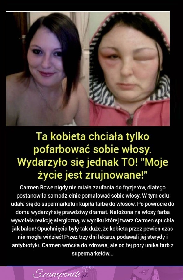 TA KOBIETA CHCIAŁA TYLKO PRZEFARBOWAĆ WŁOSY, ZOBACZ CO JEJ SIĘ STAŁO...