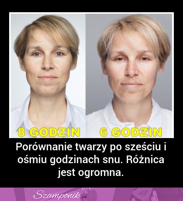 Zobacz PORÓWNANIE TWARZY KOBIETY po 6 i 8 godzinach SNU,DOBRE!