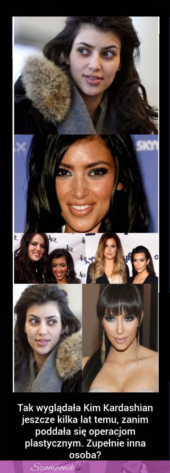 Tak wyglądała Kim Kardashian jeszcze kilka lat temu! Ile ona miała OPERACJI!