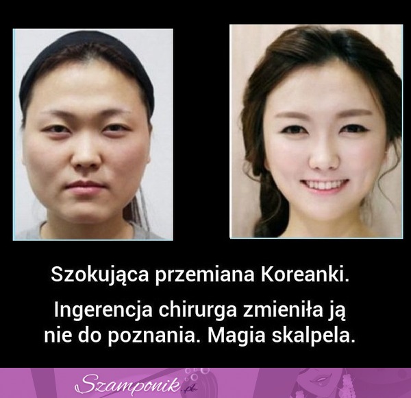 PRZEMIANA pewnej KOREANKI szokuje! Musisz zobaczyć jak ją zmienili!