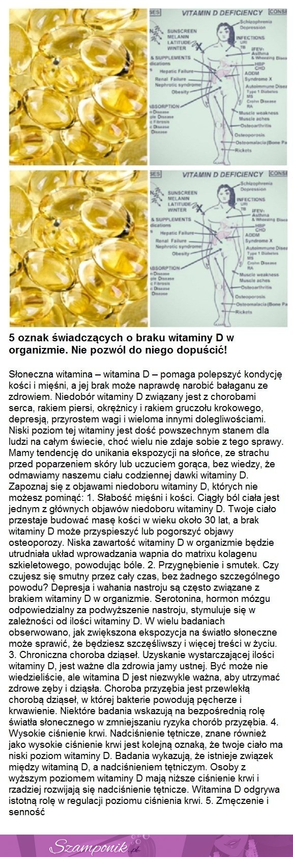 5 oznak świadczących o braku witaminy D w organizmie. Nie pozwól do tego dopuścić!