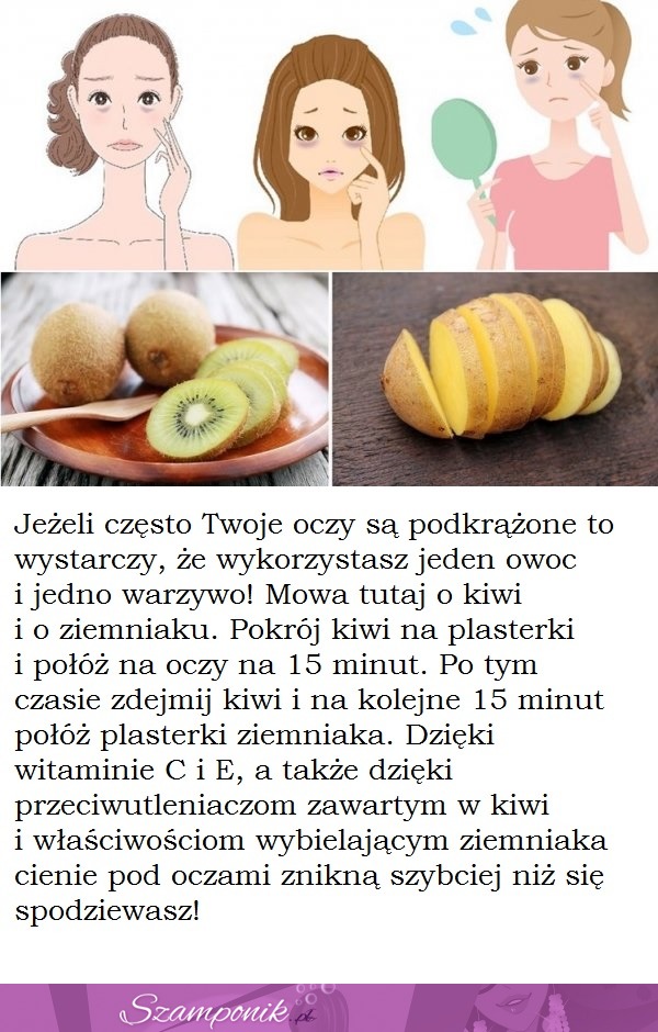 Pozbądź się cieni pod oczami naturalnym sposobem!