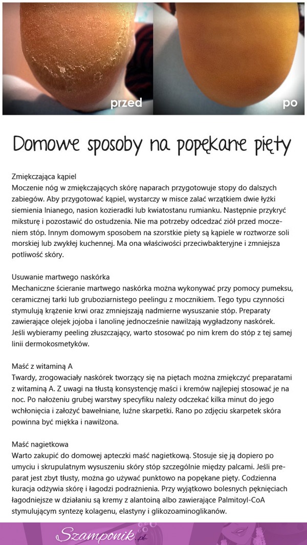 Domowe SPOSOBY na popękane stopy... To DZIAŁA!