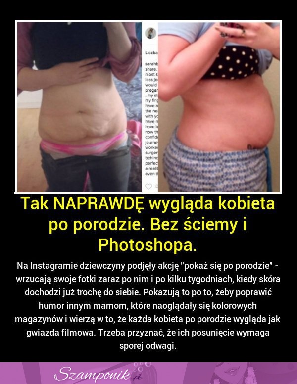 Tak naprawdę wygląda KOBIETA po porodzie! I to bez żadnej ŚCIEMY i PHOTOSHOPA!