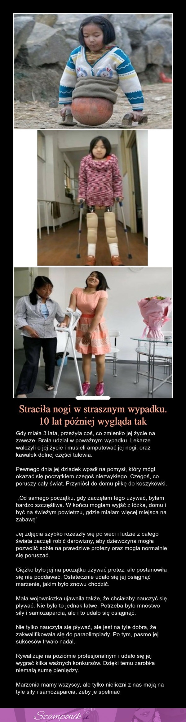 Straciła nogi w strasznym wypadku. 10 lat później wygląda tak...