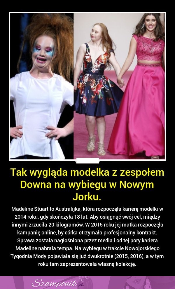 Tak wygląda MODELKA z zespołem DOWNA... ŚLICZNA dziewczyna!