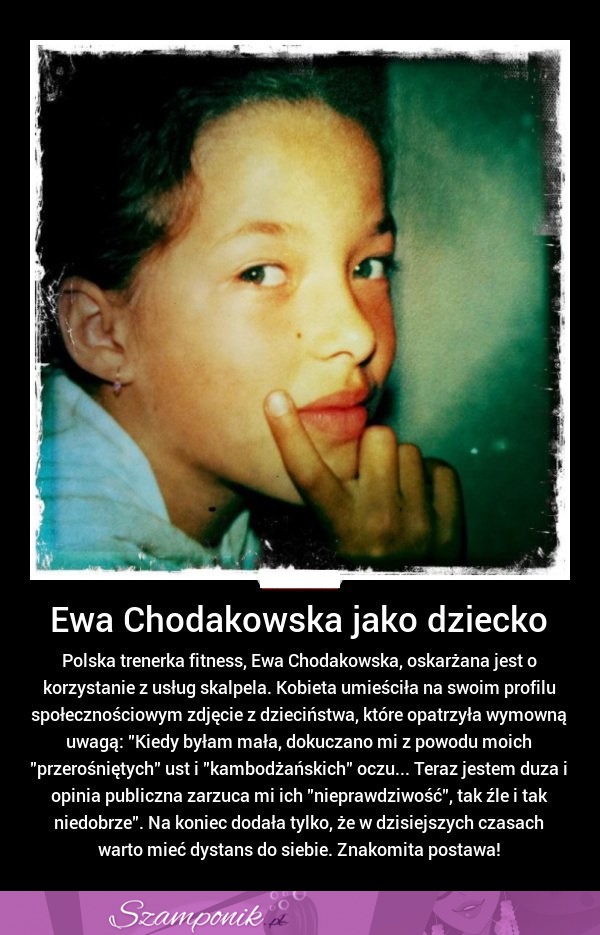 Ewa Chodakowska oskarżona jest o korzystanie z usług skalpela