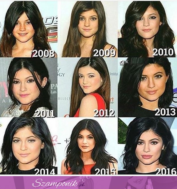 Radykalna przemiana siostry Kardashianek- Kylie Jenner od 2008 do 2016! Przesadziła i to MEGA!