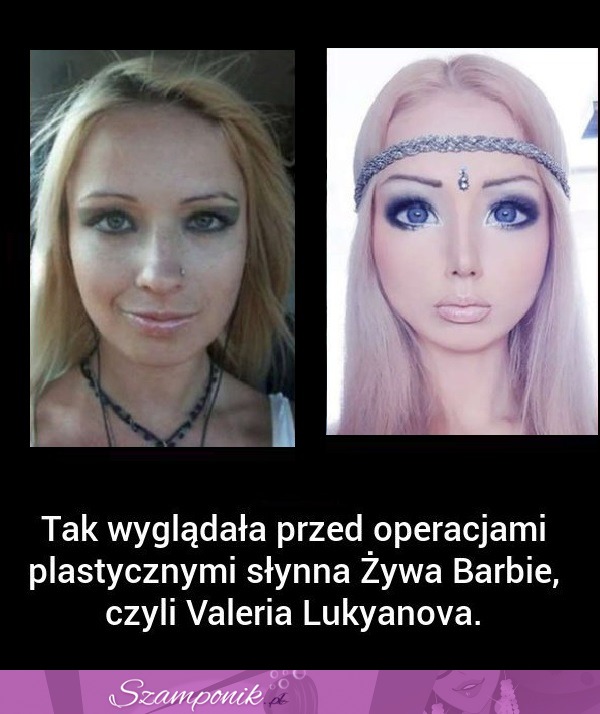 Tak wyglądała przed OPERACJAMI plastycznymi SŁYNNA żywa BARBIE! SZOK!