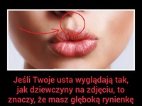 Jeśli Twoje USTA wyglądają właśnie tak to znaczy, że masz GŁĘBOKĄ....!