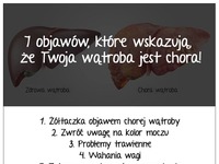 7 objawów, które wskazują, że Twoja wątroba jest chora...