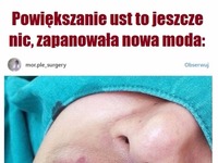 Powiększanie ust to jeszcze nic. Zapanowała NOWA MODA! Co o tym myślicie?